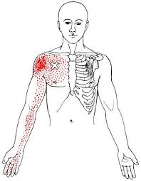 The Definitive Guide To Pectoralis Minor Anatomy Exercises Rehab Chest Muscles Trigger Points Arm Circles
