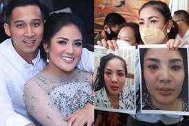 Nindy ayunda diperiksa selama 1,5 jam kasus senjata api suaminya, askara parasady harsono dan terungkap punya senpi sejak 2018. Pergoki Askara Selingkuh Lebih Dari Satu Wanita Nindy Ayunda Sempat Depresi Hingga Disangka Pakai Narkoba Badan Saya Kurus Banget Tahun 2018 Semua Halaman Grid Hot