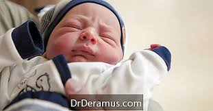 Laryngomalacia is a condition most common in young babies. Laringomalacia Tratamiento Causas Diagnostico Perspectivas Y Mas Salud 2021