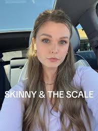 715 Bella Skinner Before