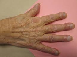 Image result for Digital Clubbing