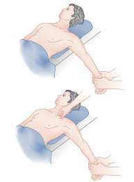 Image result for SC Dislocation