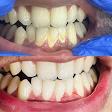 Scaling and polishing product image