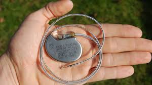 When your heart rate drops below the set rate, the pacemaker generates (fires) an impulse that passes through the lead to the heart muscle. Is The Pacemaker The Answer To All Heart Problems Professor Martin Elliott Youtube