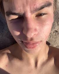 Hello guys!!! My name is Dalton Hughes and I'm from Keytesville, MO. I am  100% committed to Mizzou and I plan