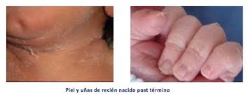 Sintesis Med Uchile Cl Sintesis Med Uchile Cl