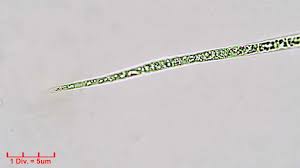 Image result for Raphidiocystis
