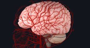Bruits (the rough sound of turbulent blood flow through narrowed arteries) heard with a stethoscope in the neck, abdomen and groin. Blood Supply To The Brain Complete Anatomy