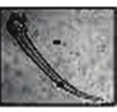 Image result for Melastomastrum capitatum