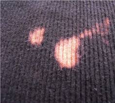 For larger stains, use the same ratio (for example, one tablespoon mixed with two cups or 480 ml of water) let it sit for about five minutes. Ways To Remove Bleach Stains From Clothes