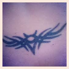 And, there were only 2 lasers to choose from to buy. Tattoo Removal Going Confidently