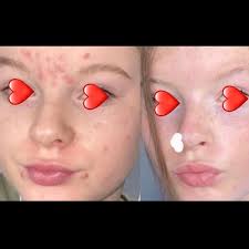 Susan Wright Skin Clinic