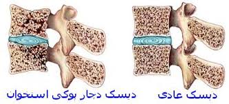 نتیجه تصویری برای محافظت از استخوان ها پس از 65 سالگی