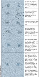 pediatric vision screening for the family physician