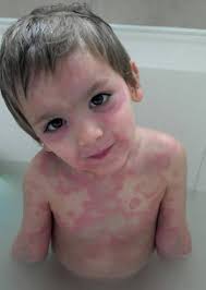 Dhruv had to go out and "investigate weird light" he was cold, but came  back and was fine, then had "weird belly ache"