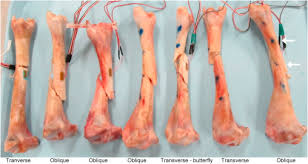 You could take your cleaver and cleave them a part, but that has a tendency to leave shards of bones in the ends. Strain Rate Dependency Of Fractures Of Immature Bone Sciencedirect