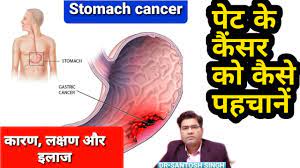 Stomach cancer can cause several symptoms. Stomach Cancer Causes Symptoms And Treatment à¤ª à¤Ÿ à¤• à¤• à¤¸à¤° à¤• à¤‡à¤² à¤œ Pet Ke Cancer Ke Lakshan Youtube