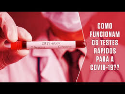 Esta tecnología, comercializada por becton dickinson y quiadel, detecta la enfermedad mediante un. Como Funcionam Os Testes Rapidos Para A Covid 19 Super Responde Youtube