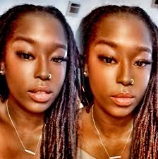 What is happening to my zucchini seedling?