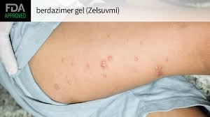 Image result for Berdazimer