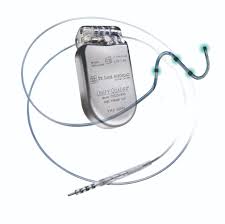 An arrhythmia is an irregular heart rate or a heart rate that is too fast or too slow. Advances In Implantable Cardioverter Defibrillator Technology Daic