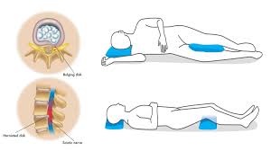 When you have pain in your neck or upper back that you've never felt before, you might have a herniated cervical disk. Scientists Explain The Best Sleep Postures To Reduce Back Pain