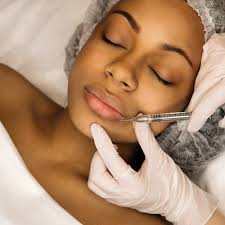 Dermal Fillers