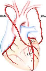 It is a paired artery, with one running along each side of the sternum, to continue after its bifurcation as the superior epigastric and musculophrenic arteries. Total Arterial Coronary Grafting Outcomes Concerns And Controversies