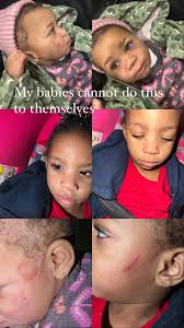 Daycare Abuse in Blaine, MN: A Mother's Nightmare