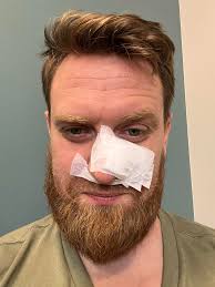 National Remove Nose Mark Day Humor