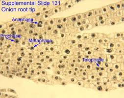 The light microscope is used to magnify the structures of certain organelles like cell walls, vacuoles, cytoplasm, chloroplasts, nucleus and cell membrane. Cytology