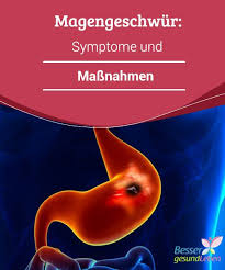 Magengeschwur Symptome Und Massnahmen Besser Gesund Leben Magengeschwur Geschwur Magen