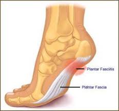 Pin On Fitness