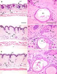 Image result for Comedolytic
