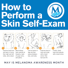 Image result for Self Skin Exam