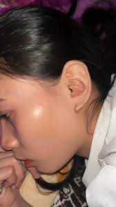 What #ticks #ticksremoval #ticksdog #ticksouthafrica #ticksonhand