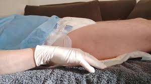 Urinating in a diaper with an inserted catheter after filling the bladder,  relaxing...