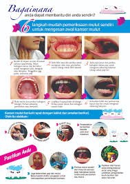If cancer cells have spread to the lymph nodes in your neck or if there's a high risk that this has happened based on the size or depth of your cancer, your surgeon may recommend a procedure to remove lymph nodes and related tissue in your neck (neck dissection). Self Check Oral Cancer Malaysian Dental Association