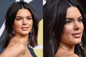 Jun 10, 2021 · want to snag kendall jenner's workout wardrobe? When Kendall Jenner Walked Golden Globes Red Carpet With Visible Acne See Viral Pics