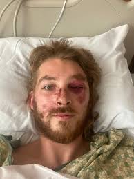 I had never heard of this paediatric neurological condition, would never  have spotted even it if it happened right in front of me, and it can be  very time sensitive with lost