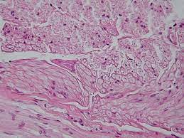 ↑fiber bundle, ↑fibre bundle, ↑fascicle, ↑fasciculus … useful english dictionary. Nervous Tissue Wikipedia