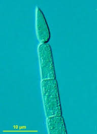 Image result for Cylindropsis