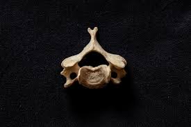 As obvious as it may sound, simply resting the afflicted areas can help the body repair any strains in the affected muscles, promoting a quicker recovery. physical therapyand specialized stretches can also soothe tight muscles and restore their strength and flexibility. Get Rid Of Neck Pain And Stiffness With This 5 Mobility Routine