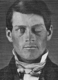 Phineas Gage