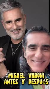 miguel varoni antes y después #MiguelVaroni #noticias #chismes #famosos  #farandula #colombia #television #novelas