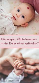 Hamangiom Blutschwamm Was Ist Der Erdbeerfleck Blutschwammchen Kinderkrankheiten Sauglinge