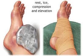 Once the bandage is back around the top of the foot, you can tug it a little to keep it taut and to keep the end in place. Foot And Ankle Conditions Ankle Sprain Rehabilitation Exercises