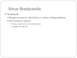 Cardiac Arrhythmias A Guide For Medical Students Ppt Video Online Download