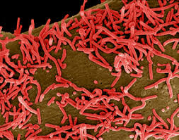 Image result for Filoviridae