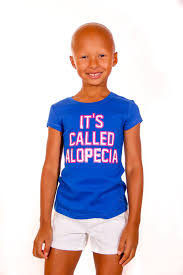 It S Called Alopecia Ucbu Ucanbu Ucbulife Girlpower Naturalbeauty Innerbeauty Coolkid Glowing Prettysm Alopecia Hair Loss Alopecia Hair Loss